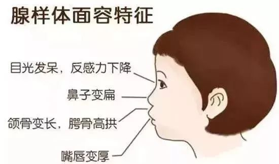 影响孩子发育宝宝的鼻腔堵塞,须用口呼吸,宝宝的上颌骨就会发育不剂 
