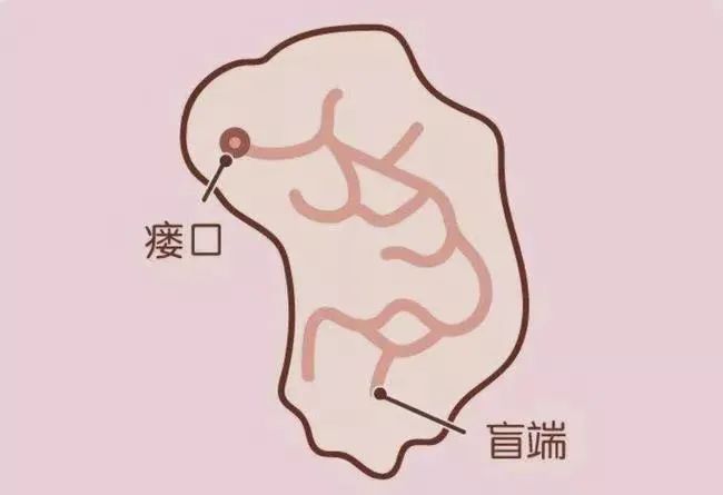 锁骨瘘管图片